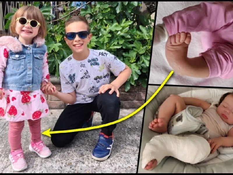 Ina je rođena s deformiranom lijevom nogom koja je danas gotovo pa potpuno ispravljena/Foto: Privatni album