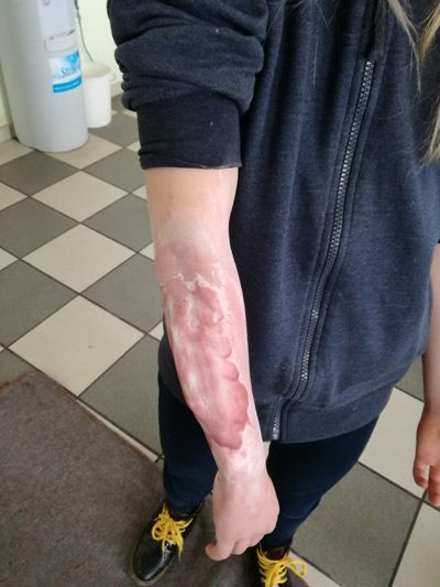 Foto: Facebook stranica 'Gradsko društvo Crvenog križa Pakrac'